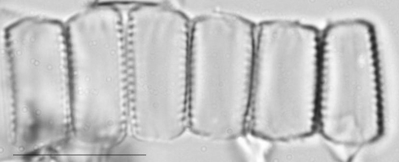 Pseudostaurosira neoelliptica LM2