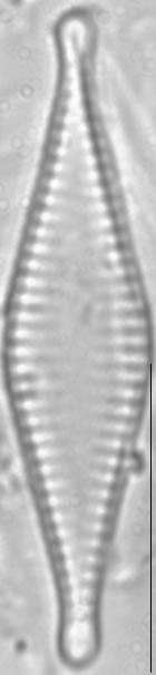 Pseudostaurosira parasitica LM1