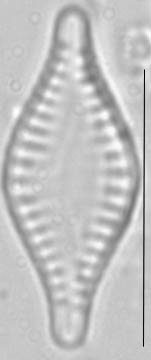 Pseudostaurosira parasitica LM3