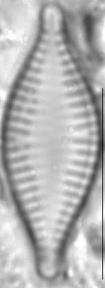 Pseudostaurosira parasitica LM5