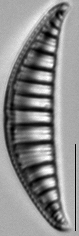 Rhopalodia gibberula LM9