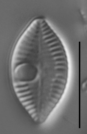 Skabitschewskia oestrupii LM6