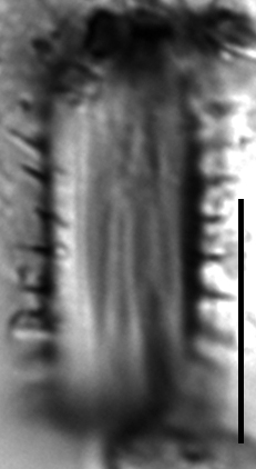 Stephanodiscus hantzschii LM6