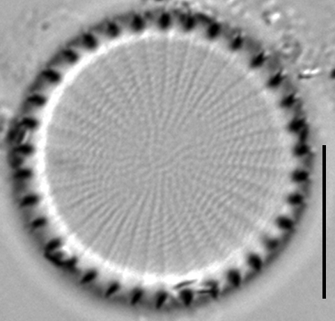 Stephanodiscus hantzschii f tenuis LM3