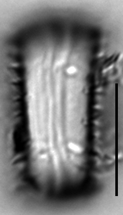 Stephanodiscus hantzschii f tenuis LM1