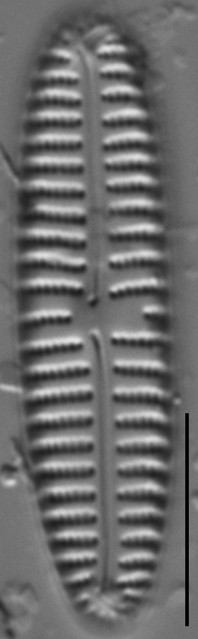 Encyonema appalachianum LM7