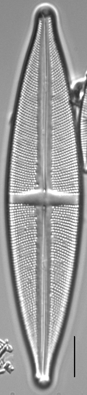 Stauroneis conspicua LM5