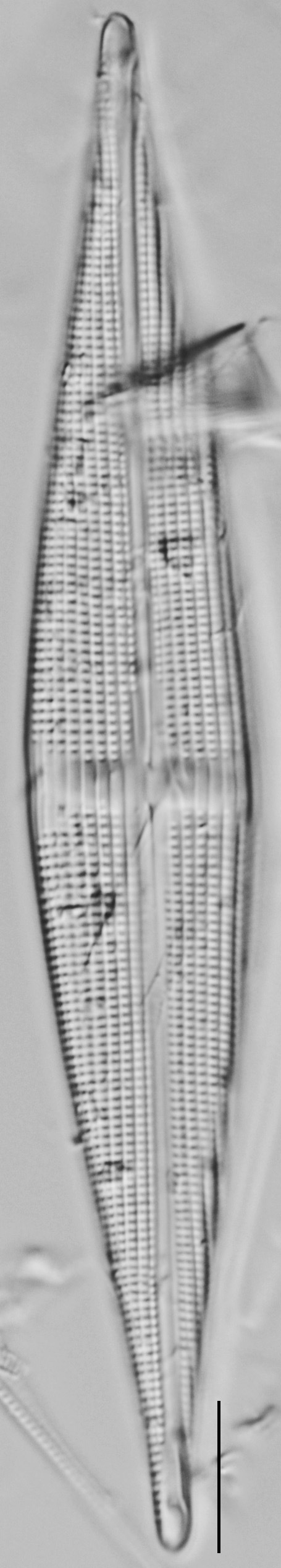 Stauroneis staurolineata LM6