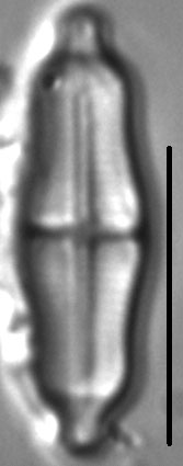 Stauroneis separanda LM5