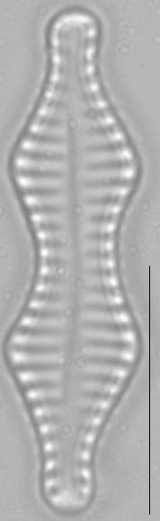 Staurosira construens var binodis LM1