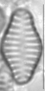Staurosira construens var binodis LM2