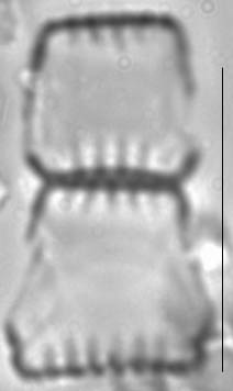 Staurosira construens var venter LM5