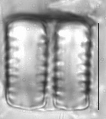 Staurosirella leptostauron LM5