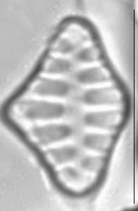 Staurosirella leptostauron LM3