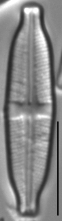 Stauroneis kriegeri LM5