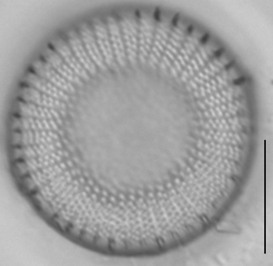 Stephanodiscus medius LM2