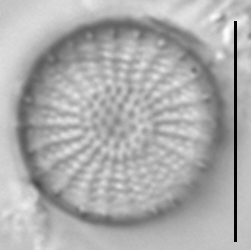 Stephanodiscus medius LM1