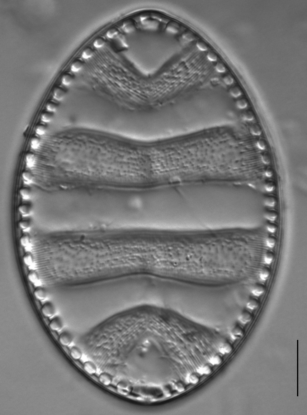 Surirella undulata LM7