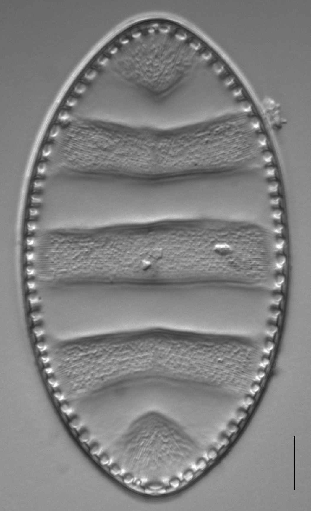 Surirella undulata LM3