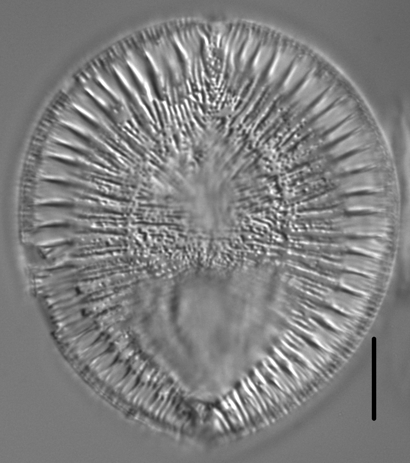 Surirella crumena LM5