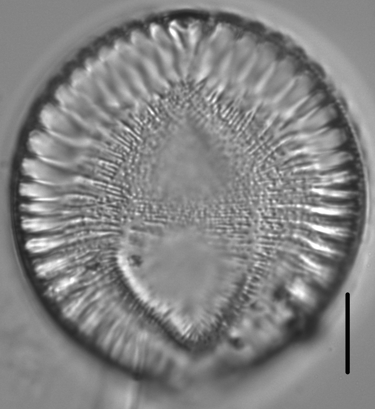 Surirella crumena LM2