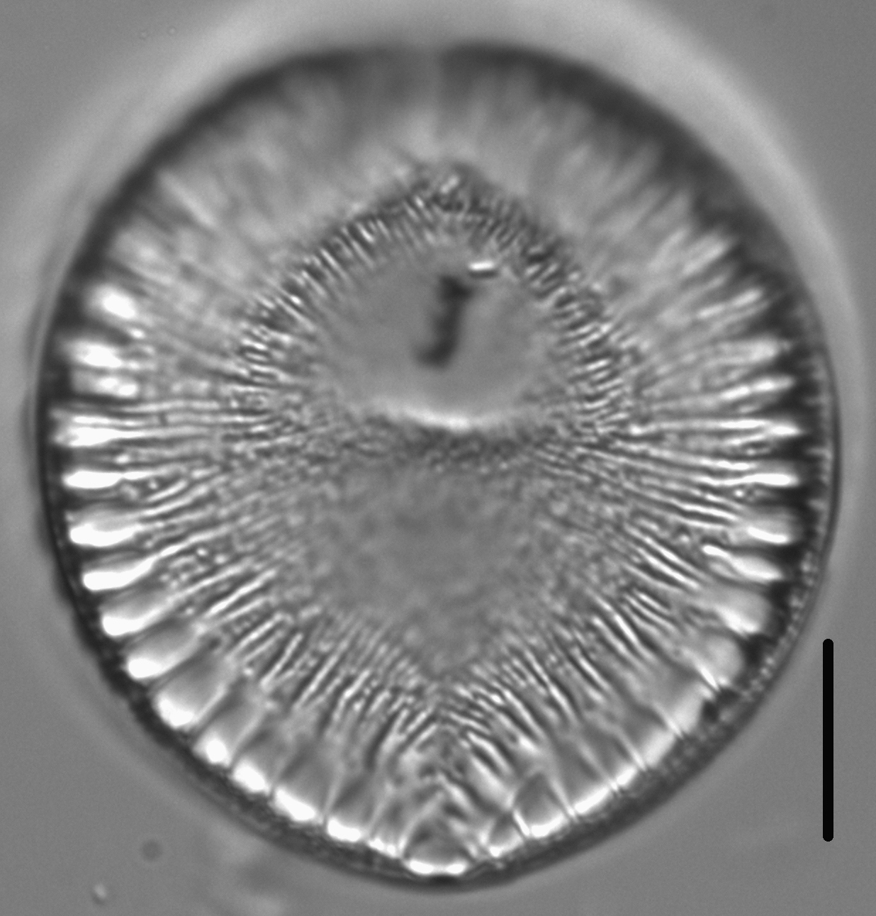 Surirella crumena LM1