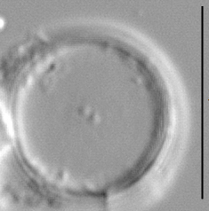 Thalassiosira minima LM4