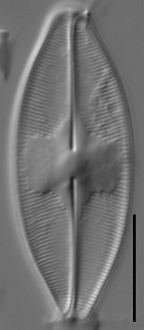 Eucocconeis americana LM5