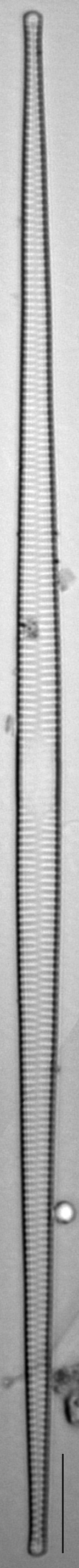 Ulnaria sp. IT ILL 2015 LM1