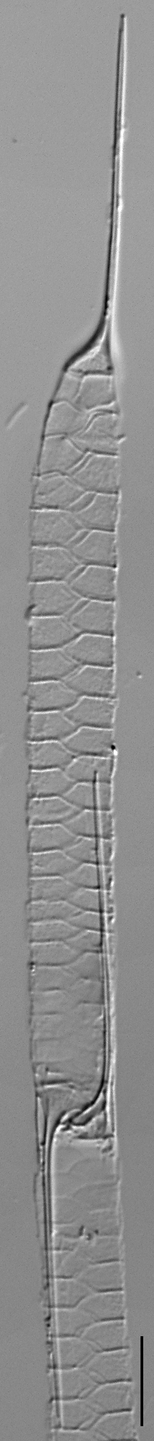 Urosolenia Eriensis Lm3B