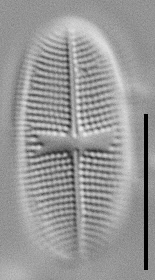 Psammothidium alpinum LM7