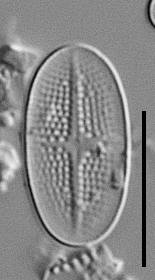 Psammothidium alpinum LM5