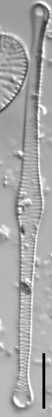 Tabellaria fenestrata LM1