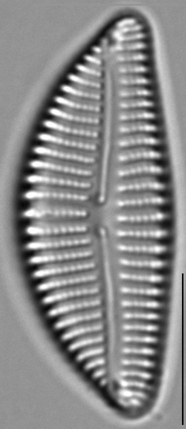 Encyonema auerswaldii LM1