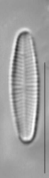 Achnanthidium minutissimum LM2