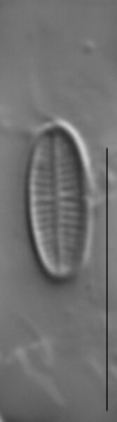 Achnanthidium minutissimum LM5