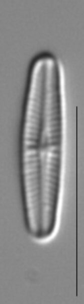 Achnanthidium minutissimum LM6