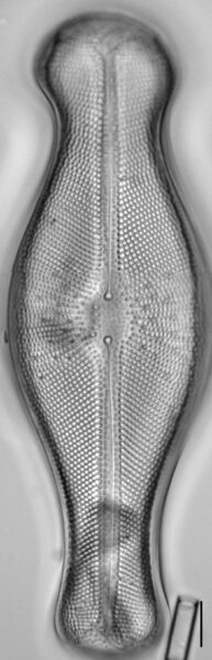 Didymosphenia geminata LM4