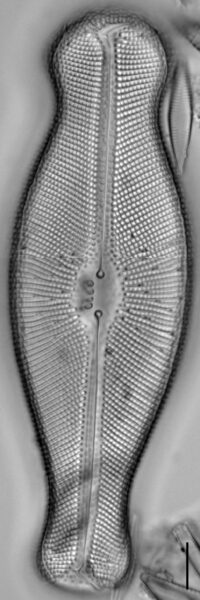 Didymosphenia geminata LM6