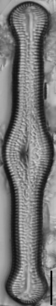 Pinnularia turgidula LM2