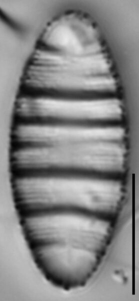 Odontidium hyemale LM2