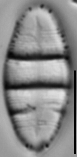 Odontidium hyemale LM3