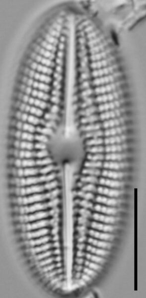 Diploneis abscondita LM2