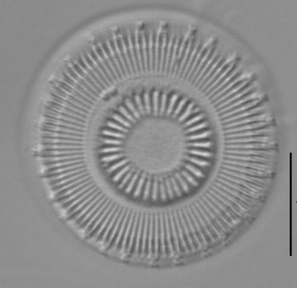 Discostella asterocostata LM3