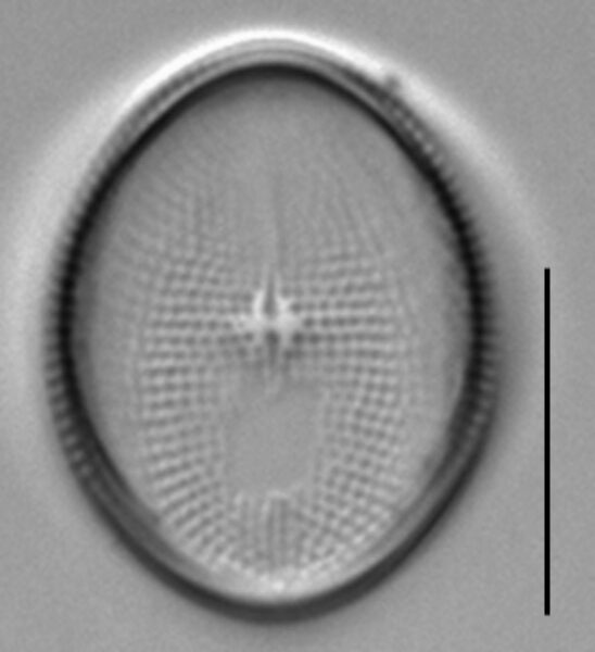 Cocconeis pediculus LM1