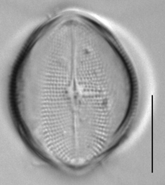 Cocconeis pediculus LM2