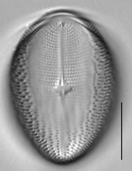 Cocconeis pediculus LM3