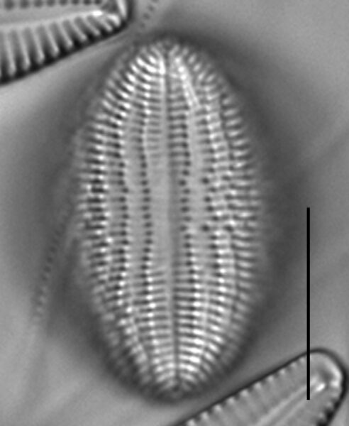 Cocconeis pediculus LM5