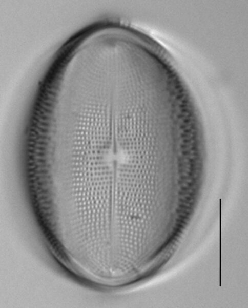 Cocconeis pediculus LM6