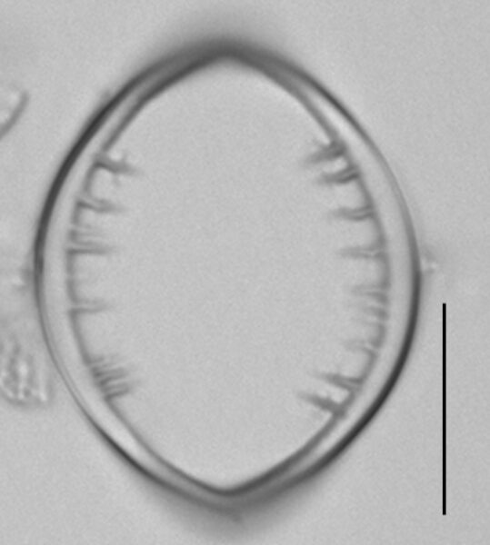 Cocconeis pediculus LM7